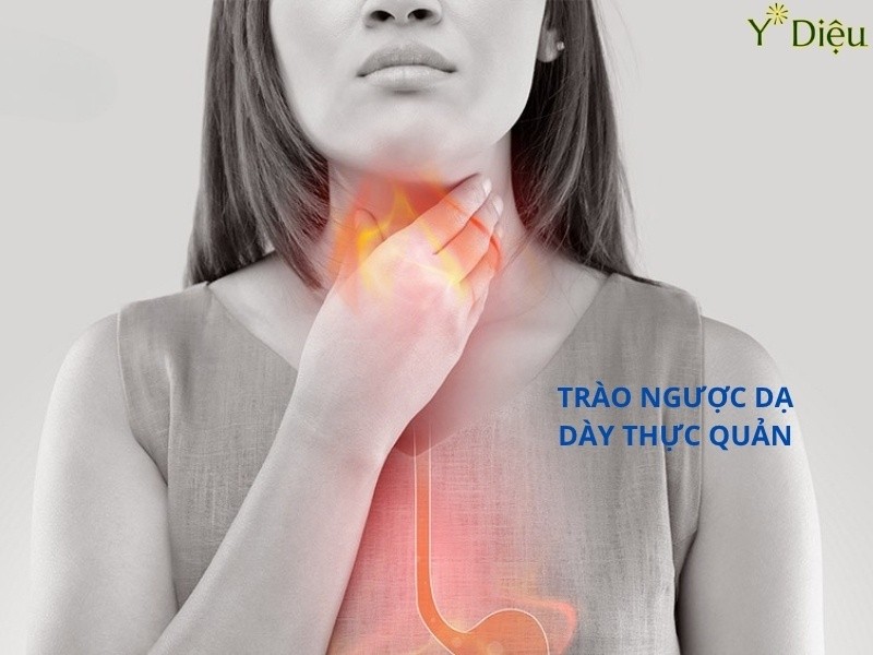 Điều Trị Trào Ngược Dạ Dày Dứt Điểm Không Phải Ai Cũng Biết